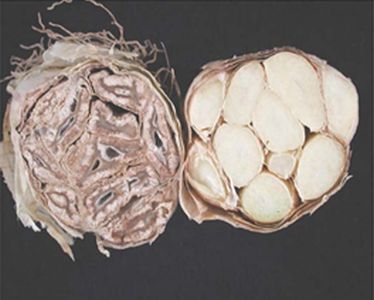 Choroby cesnaku - Botrytída (Botrytis spp.) - Vľavo úplne zničená hlávka cesnaku Botrytídou v porovnaní so zdravou vpravo